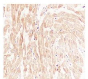 NFKB2 Recombinant Rabbit Monoclonal Antibody