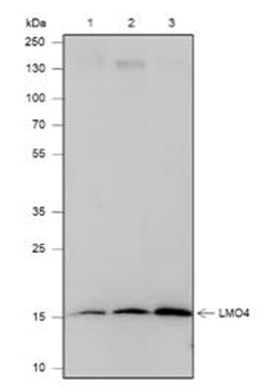 LMO4 Recombinant Rabbit Monoclonal Antibody