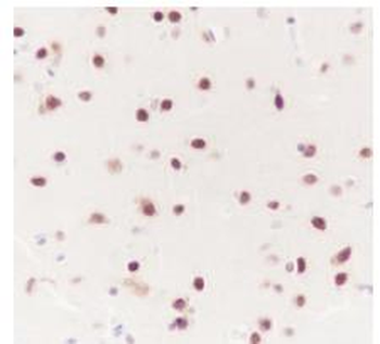 AKT1 / AKT2 / AKT3 Recombinant Rabbit Monoclonal Antibody