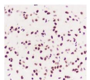 AKT1 / AKT2 / AKT3 Recombinant Rabbit Monoclonal Antibody