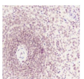ATF1 Recombinant Rabbit Monoclonal Antibody