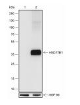 HSD17B1 Recombinant Rabbit Monoclonal Antibody
