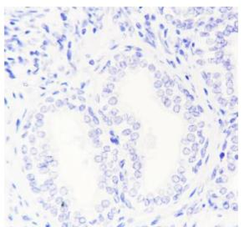 HSD17B1 Recombinant Rabbit Monoclonal Antibody