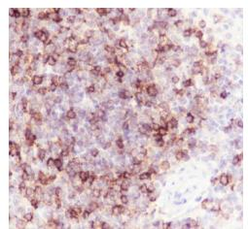 CD1c Recombinant Rabbit Monoclonal Antibody