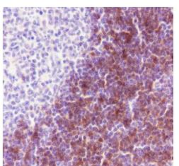 CD1c Recombinant Rabbit Monoclonal Antibody