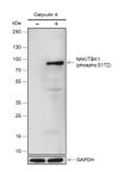 Phospho-TBK1 (Ser172) Recombinant Rabbit Monoclonal Antibody