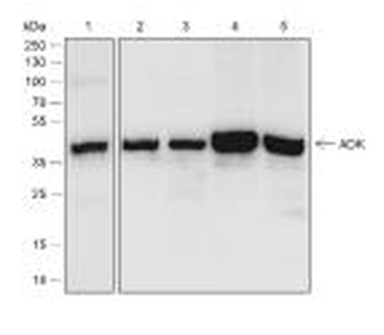 ADK Recombinant Rabbit Monoclonal Antibody