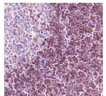 ADK Recombinant Rabbit Monoclonal Antibody