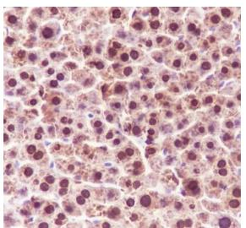 ADK Recombinant Rabbit Monoclonal Antibody