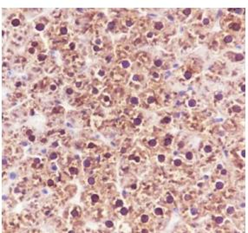 ADK Recombinant Rabbit Monoclonal Antibody