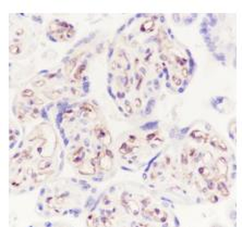 Moesin Recombinant Rabbit Monoclonal Antibody