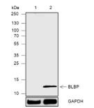 BLBP Recombinant Rabbit Monoclonal Antibody