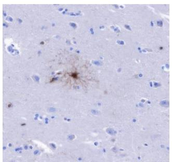 BLBP Recombinant Rabbit Monoclonal Antibody