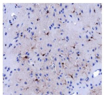 BLBP Recombinant Rabbit Monoclonal Antibody