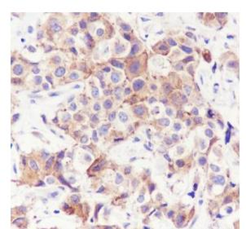 RAB7A Recombinant Rabbit Monoclonal Antibody