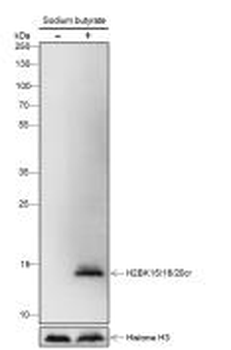 Histone H2B (Crotonyl-Lys15 / Lys16 / Lys20) Recombinant Rabbit Monoclonal Antibody