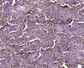 CD20 Recombinant Rabbit Monoclonal Antibody