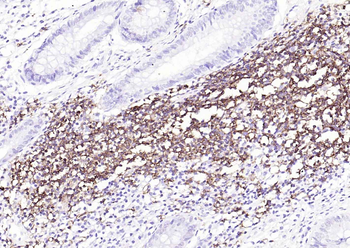 CD20 Recombinant Rabbit Monoclonal Antibody