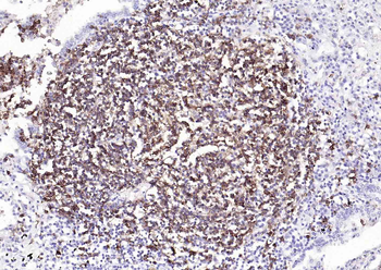 CD20 Recombinant Rabbit Monoclonal Antibody