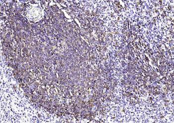 CD20 Recombinant Rabbit Monoclonal Antibody