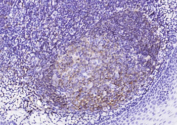 CD20 Recombinant Rabbit Monoclonal Antibody