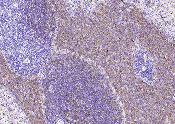 CD20 Recombinant Rabbit Monoclonal Antibody