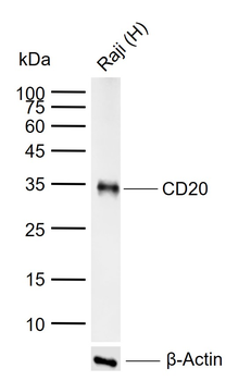 CD20 Recombinant Rabbit Monoclonal Antibody