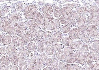 Claudin 18.2 Recombinant Rabbit Monoclonal Antibody