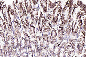 Claudin 18.2 Recombinant Rabbit Monoclonal Antibody
