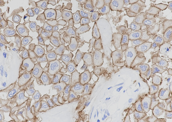 ERBB2/HER2 Recombinant Rabbit Monoclonal Antibody