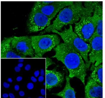 PLIN2 Recombinant Rabbit Monoclonal Antibody