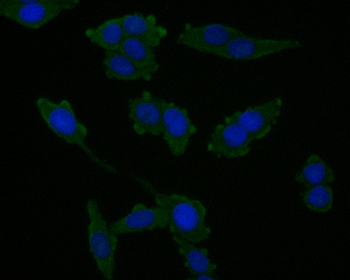 CHMP2B Recombinant Rabbit Monoclonal Antibody