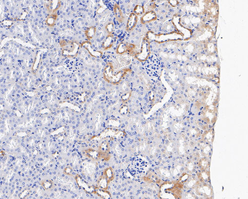 CHMP2B Recombinant Rabbit Monoclonal Antibody