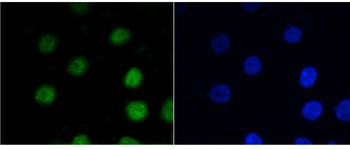 Phospho-V-Myb+C-Myb (Ser11) Recombinant Rabbit Monoclonal Antibody