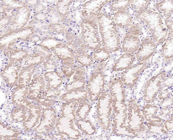 MARK2 Recombinant Rabbit Monoclonal Antibody