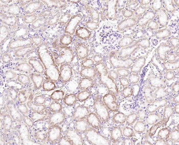 MARK2 Recombinant Rabbit Monoclonal Antibody