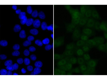 BRD2 Recombinant Rabbit Monoclonal Antibody