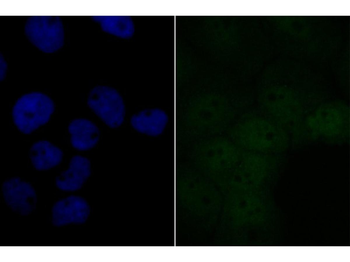 BRD2 Recombinant Rabbit Monoclonal Antibody