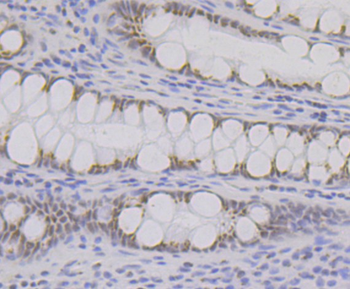 BRD2 Recombinant Rabbit Monoclonal Antibody