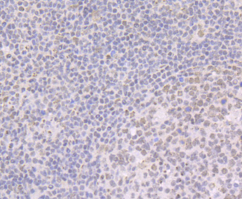 BRD2 Recombinant Rabbit Monoclonal Antibody