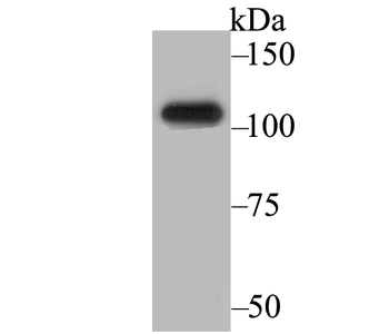 BRD2 Recombinant Rabbit Monoclonal Antibody
