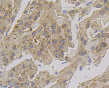 ADH1A Recombinant Rabbit Monoclonal Antibody