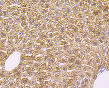 ADH1A Recombinant Rabbit Monoclonal Antibody