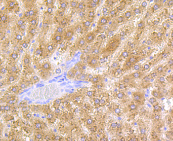 ADH1A Recombinant Rabbit Monoclonal Antibody