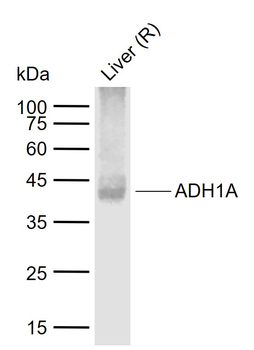 ADH1A Recombinant Rabbit Monoclonal Antibody