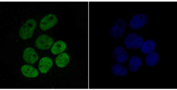 Histone H4 (acetyl K16) Recombinant Rabbit Monoclonal Antibody