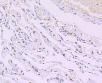 Histone H4 (acetyl K16) Recombinant Rabbit Monoclonal Antibody