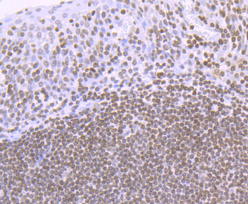 Histone H4 (acetyl K16) Recombinant Rabbit Monoclonal Antibody