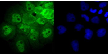PSMB8 Recombinant Rabbit Monoclonal Antibody