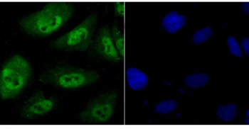 PSMB8 Recombinant Rabbit Monoclonal Antibody